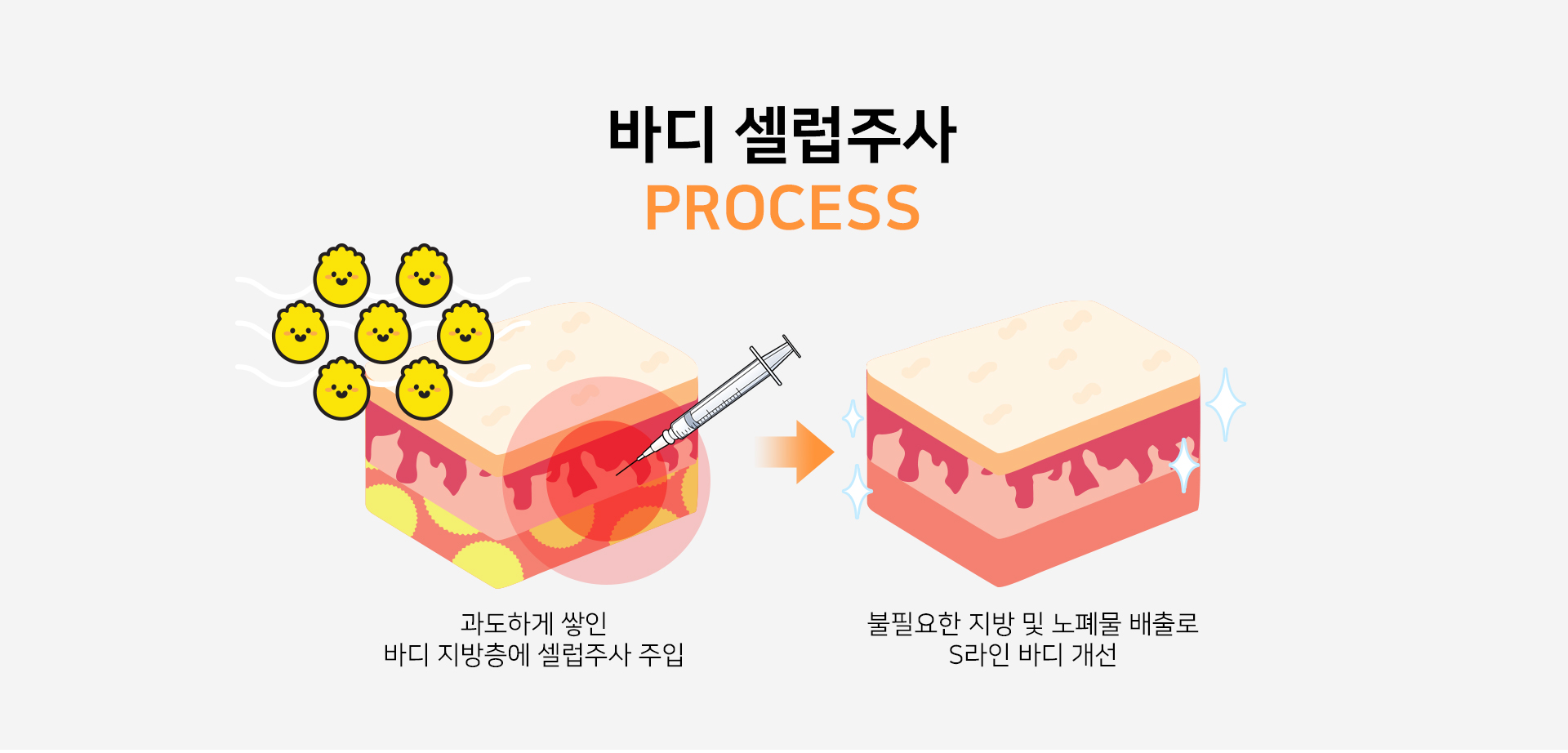 바디셀럽주사 프로세스 