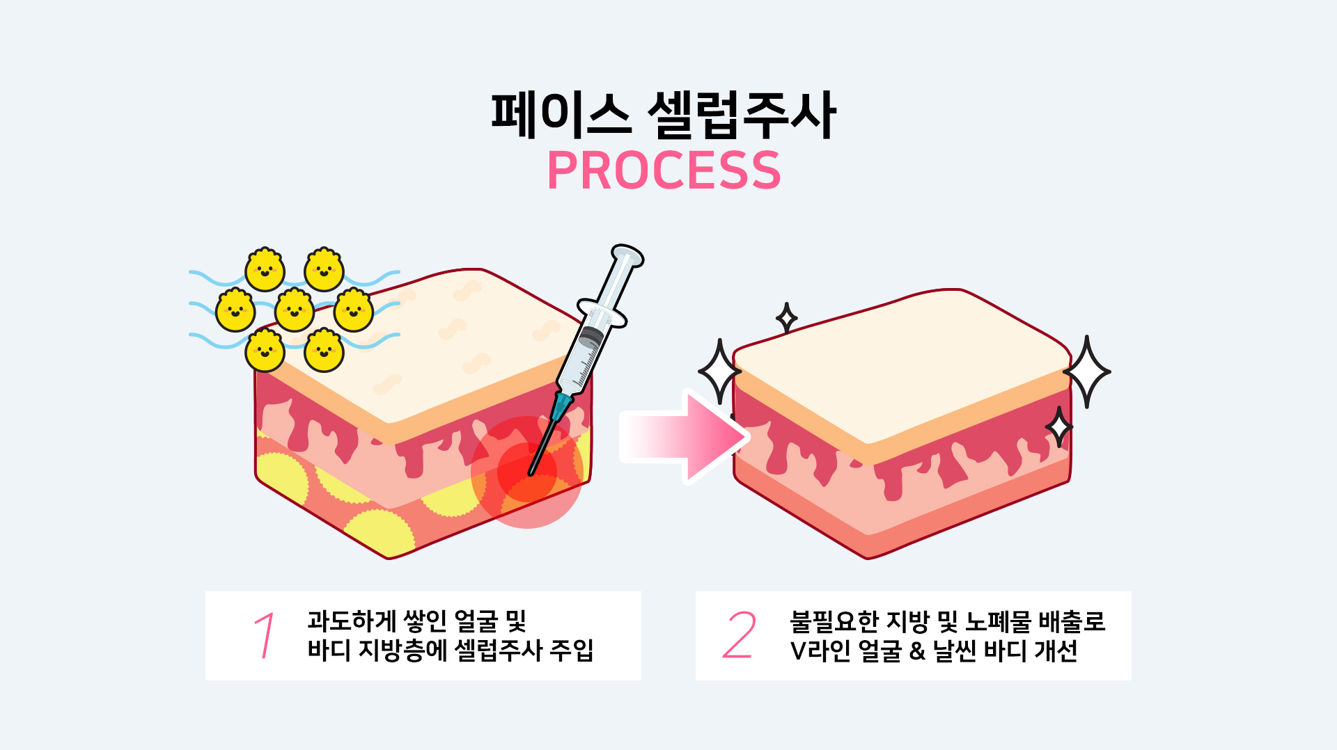 페이스셀럽주사 프로세스 